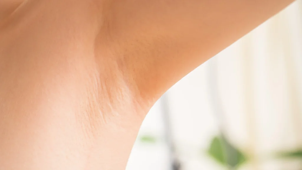 ワキ汗・ワキガ