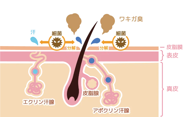 ワキガ臭発生の原因